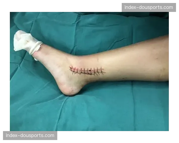 女子青少年车手训练中骨折，预计休养三个月